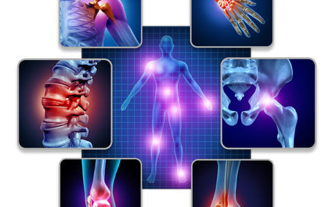 Gelenkschmerzen im menschlichen Körper - Foto: AdobeStock freshidea über pressetext.de