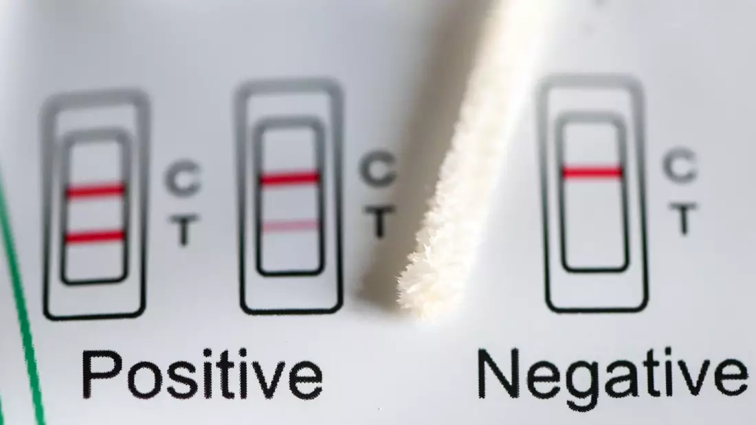 Positiv oder negativ - das zeigt ein Test an. (Symbolbild) - Bild: Jens Kalaene/dpa