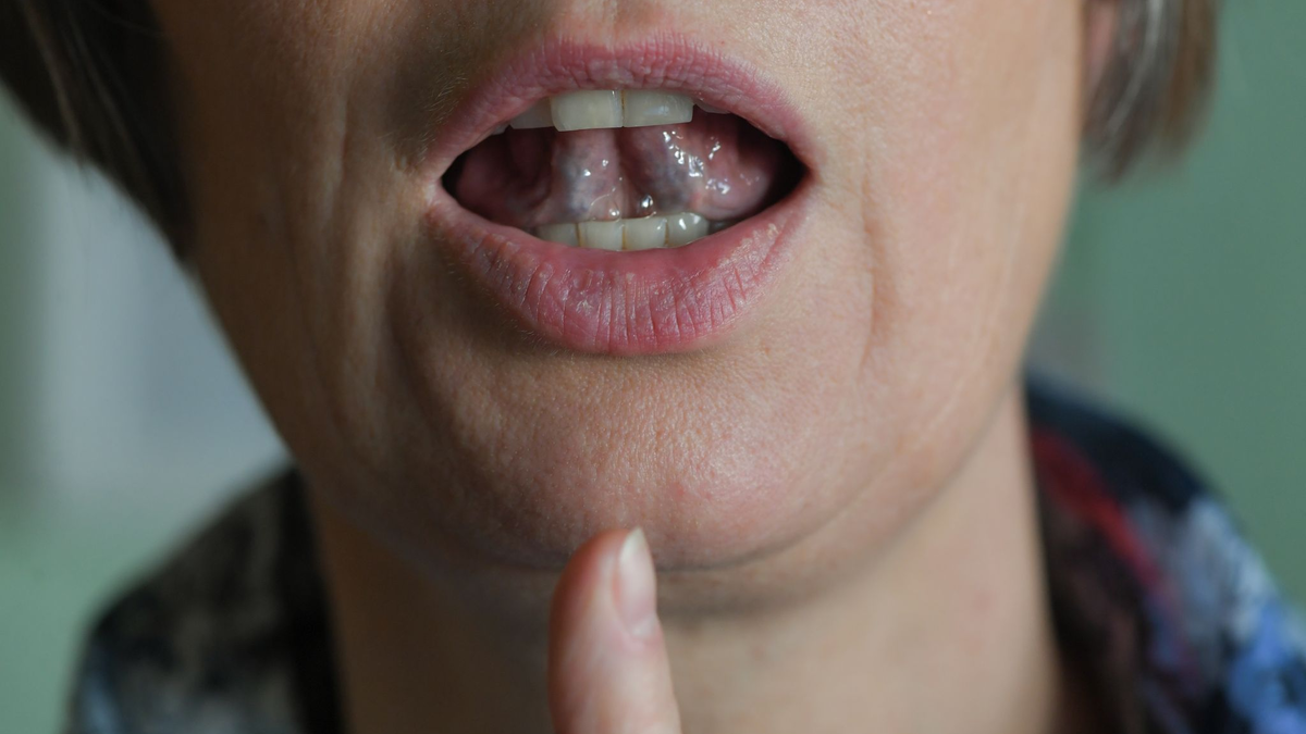 Stotternde Menschen können mit Hilfe von regelmäßigen Sprechübungen ihren Redefluss verbessern. (Symbolbild) - Foto: Jens Kalaene/zb/dpa