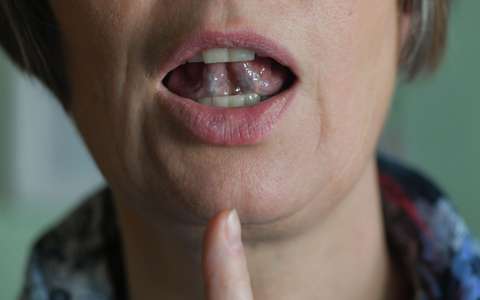 Stotternde Menschen können mit Hilfe von regelmäßigen Sprechübungen ihren Redefluss verbessern. (Symbolbild) - Foto: Jens Kalaene/zb/dpa Stotternde Menschen können mit Hilfe von regelmäßigen Sprechübungen ihren Redefluss verbessern. (Symbolbild) - Foto: Jens Kalaene/zb/dpa