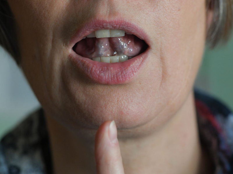 Stotternde Menschen können mit Hilfe von regelmäßigen Sprechübungen ihren Redefluss verbessern. (Symbolbild) - Foto: Jens Kalaene/zb/dpa