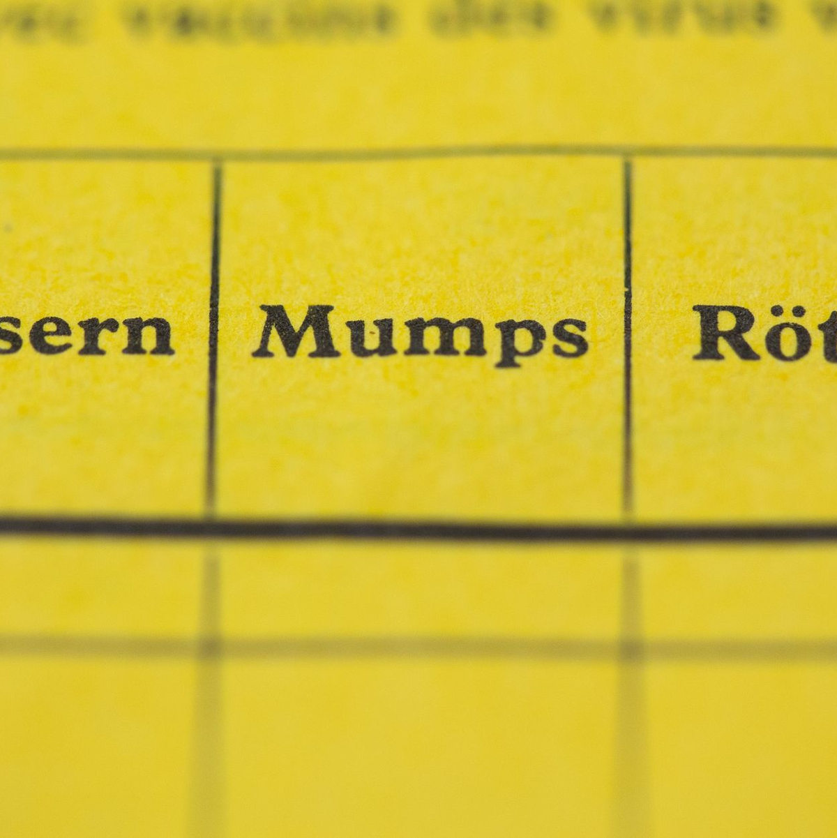 Gegen Masern, Mumps und Röteln gibt es auch Kombi-Impfstoffe. (Symbolbild) - Foto: picture alliance / Lukas Schulze/dpa