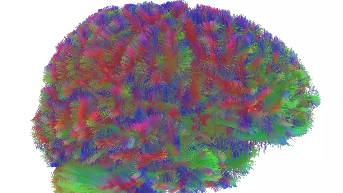 Sogenannte MRT-Diffusionsscans lassen deutliche Unterschiede der Hirnstruktur abhängig vom Alter erkennen. - Bild: Dr Alexa Mousley/University of Cambridge/dpa