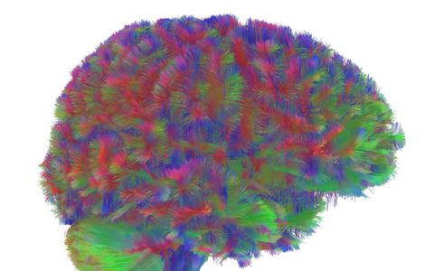 Sogenannte MRT-Diffusionsscans lassen deutliche Unterschiede der Hirnstruktur abhängig vom Alter erkennen. - Foto: Dr Alexa Mousley/University of Cambridge/dpa