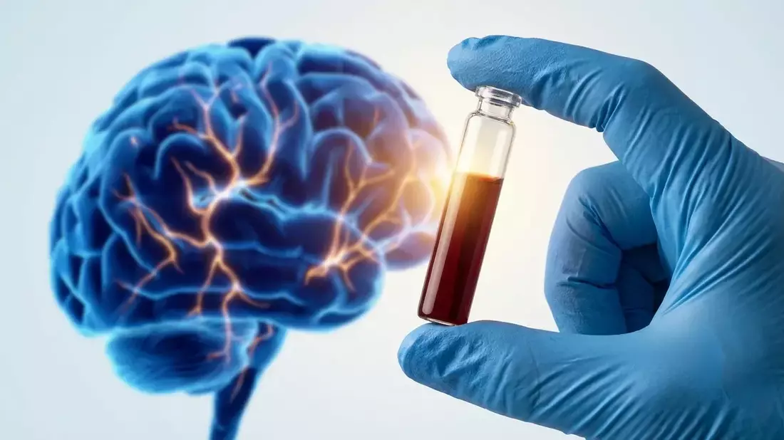 P-tau217-Bluttests: FDA-Zulassung revolutioniert Alzheimer-Früherkennung - Bild: über boerse-global.de
