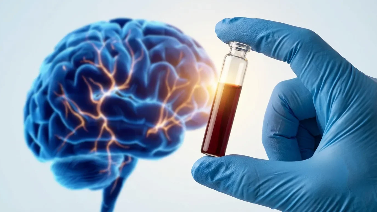 P-tau217-Bluttests: FDA-Zulassung revolutioniert Alzheimer-Früherkennung - Foto: über boerse-global.de