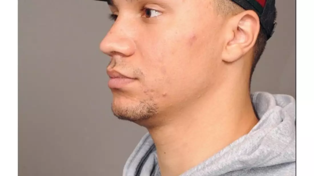 POL-H: Öffentlichkeitsfahndung: Verstoß gegen das Waffengesetz, Sachbeschädigung und Bedrohung - Wer kann Hinweise zum Aufenthaltsort von Luis Che B. (26) geben? - Bild: presseportal.de