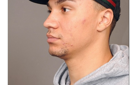 POL-H: Öffentlichkeitsfahndung: Verstoß gegen das Waffengesetz, Sachbeschädigung und Bedrohung - Wer kann Hinweise zum Aufenthaltsort von Luis Che B. (26) geben? - Foto: presseportal.de