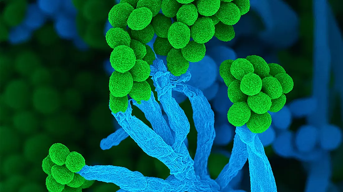 Penicillium bedeutet auf Lateinisch «kleiner Pinsel», weil die Zellketten mit Sporen am Ende so ähnlich aussehen (Handout) - Bild: Ulrich Kück/ Birgit Hoff/Vereinigung für Allgemeine und Angewandte Mikrobiologie/dpa