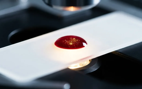 ALZpath-Studie: Alzheimer-Biomarker weit verbreiteter als gedacht - Foto: über boerse-global.de