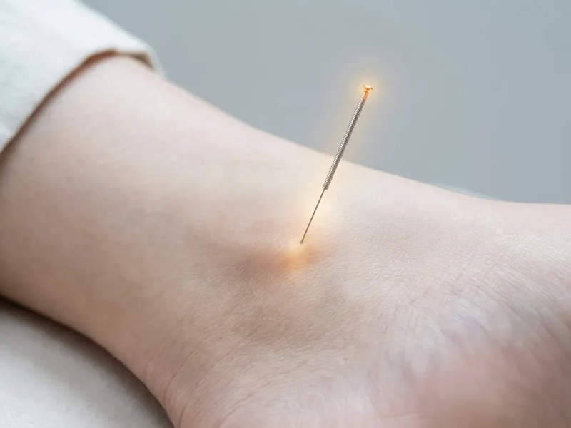 Akupunkturpunkt SP5: Geheimwaffe gegen Winter-Gelenkschmerzen? - Foto: über boerse-global.de