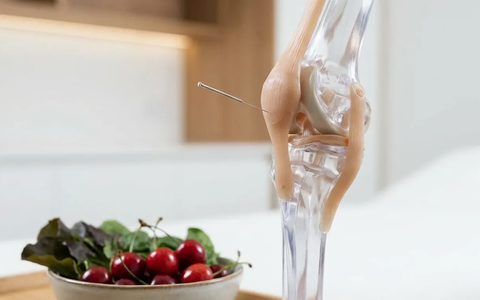 Akupunktur und Ernährung: Neue Leitlinien revolutionieren Arthrose-Therapie - Foto: über boerse-global.de