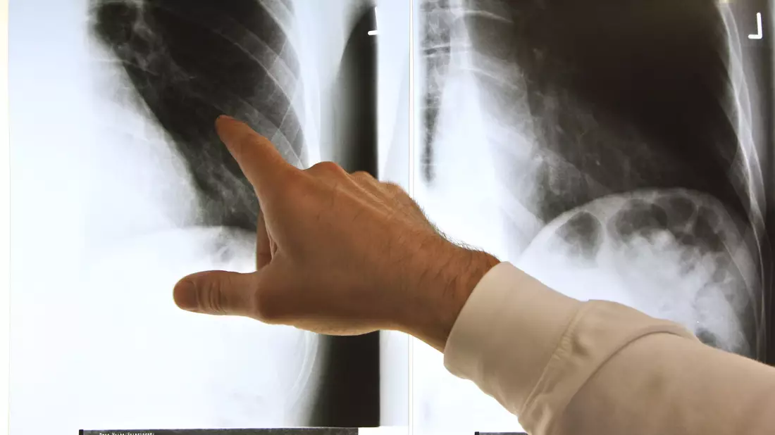 Patientenschützer sind über die geplanten Neuregelungen bei der Ärztewahl besorgt. (Archivbild) - Bild: Arno Burgi/dpa-Zentralbild/dpa