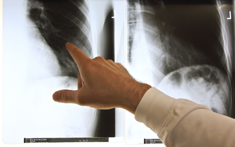 Patientenschützer sind über die geplanten Neuregelungen bei der Ärztewahl besorgt. (Archivbild) - Foto: Arno Burgi/dpa-Zentralbild/dpa