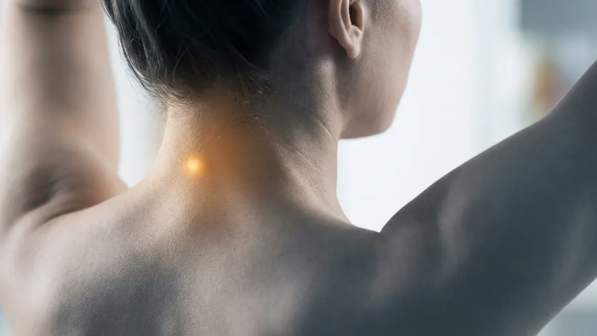 Akupunktur-Punkt GB20: Neue Studie bestätigt Wirkung bei Kopfschmerzen - Foto: über boerse-global.de