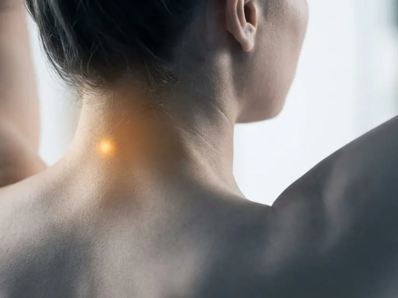 Akupunktur-Punkt GB20: Neue Studie bestätigt Wirkung bei Kopfschmerzen - Foto: über boerse-global.de