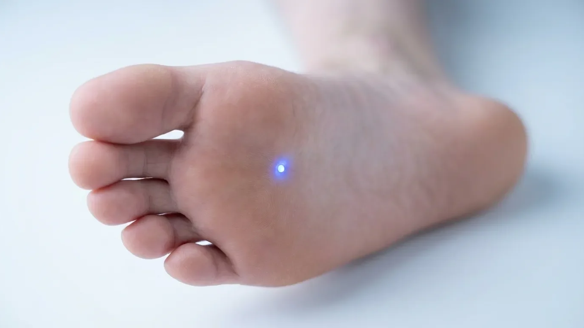 Akupunkturpunkt KI1: Neue Studien belegen Wirkung gegen Stress und Schlafstörungen - Foto: über boerse-global.de