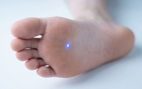 Akupunkturpunkt KI1: Neue Studien belegen Wirkung gegen Stress und Schlafstörungen - Foto: über boerse-global.de