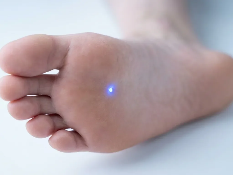 Akupunkturpunkt KI1: Neue Studien belegen Wirkung gegen Stress und Schlafstörungen - Foto: über boerse-global.de