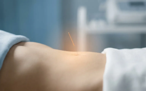 Endometriose: Neue Studie entdeckt Stoffwechsel-Link – Akupunktur gewinnt an Bedeutung - Foto: über boerse-global.de