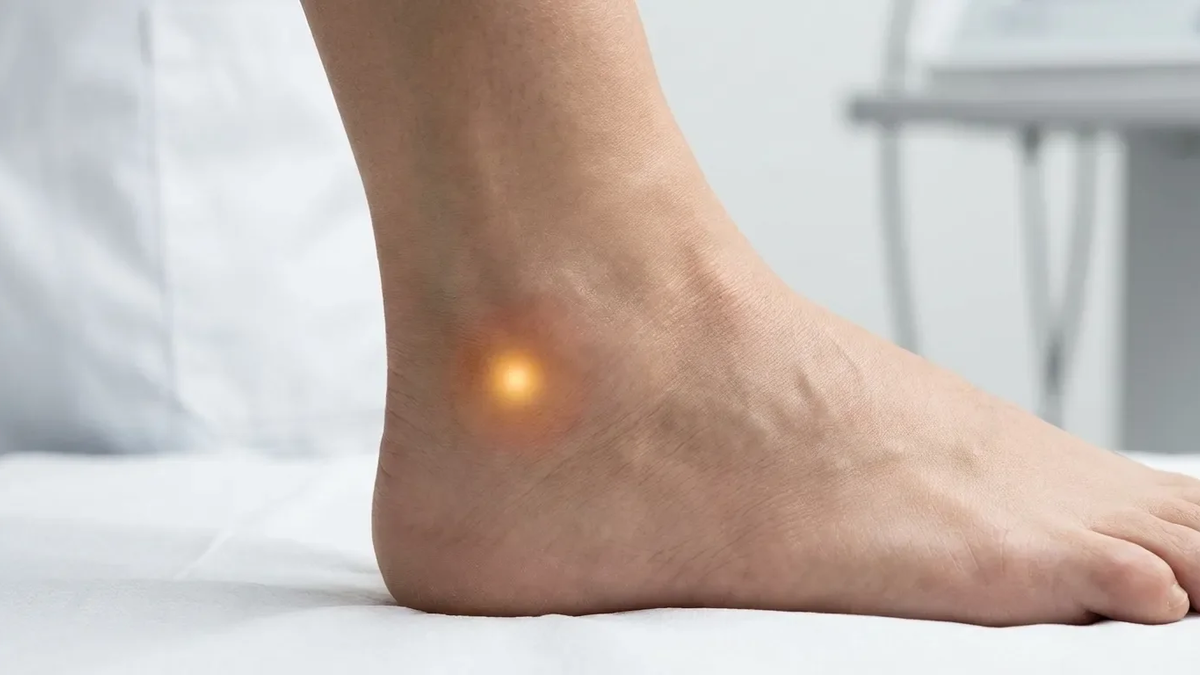 Akupunkturpunkt Blase 62: Altes Wissen gegen Wintersschmerz - Foto: über boerse-global.de