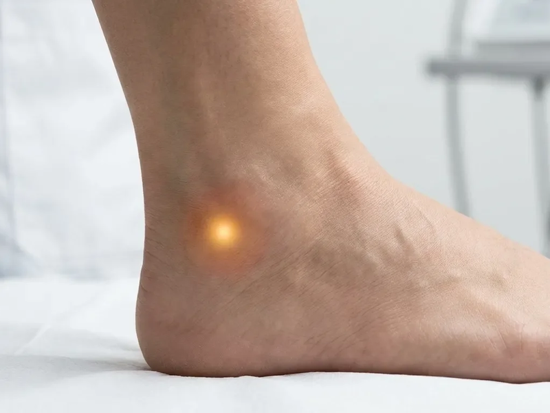 Akupunkturpunkt Blase 62: Altes Wissen gegen Wintersschmerz - Foto: über boerse-global.de