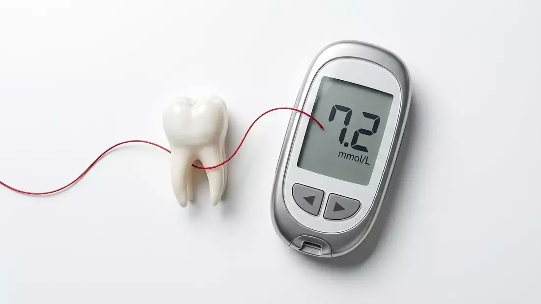Mund-Diabetes-Achse: Parodontitis verschlechtert Blutzuckerwerte - Bild: über boerse-global.de