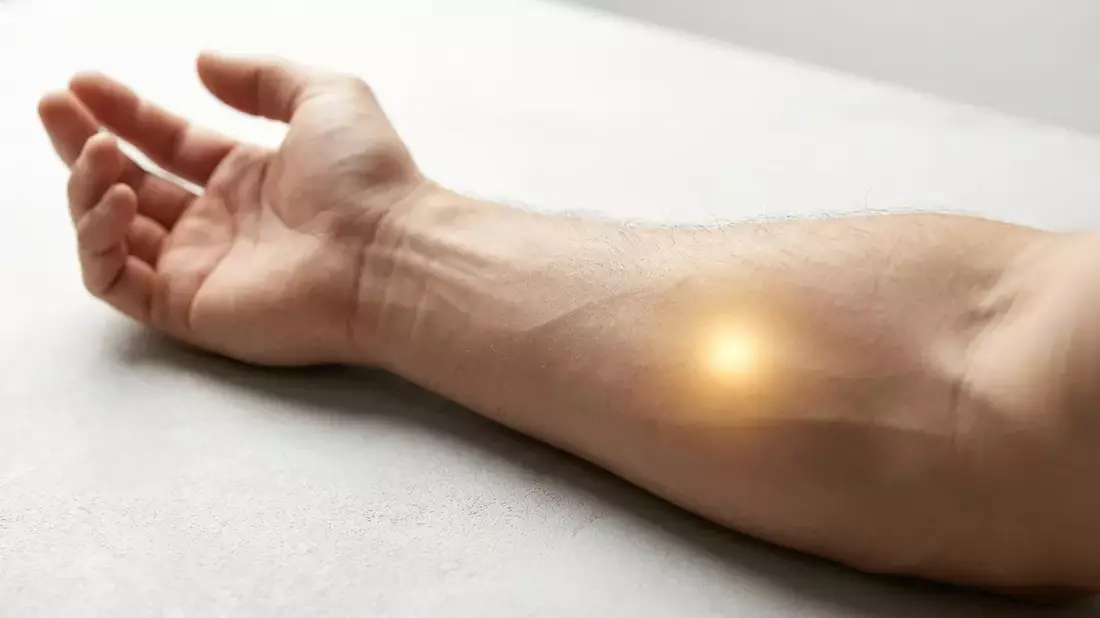 Tennisarm: Neues Protein entdeckt – Akupressur bietet sofortige Linderung - Bild: über boerse-global.de