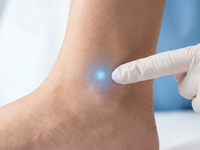 Akupunktur-Punkt Kidney 7: Neue Leitlinie setzt auf Akupressur gegen Winter-Ödeme - Foto: über boerse-global.de