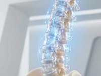 Neuroathletik revolutioniert 2026 die Rückentherapie - Foto: über boerse-global.de