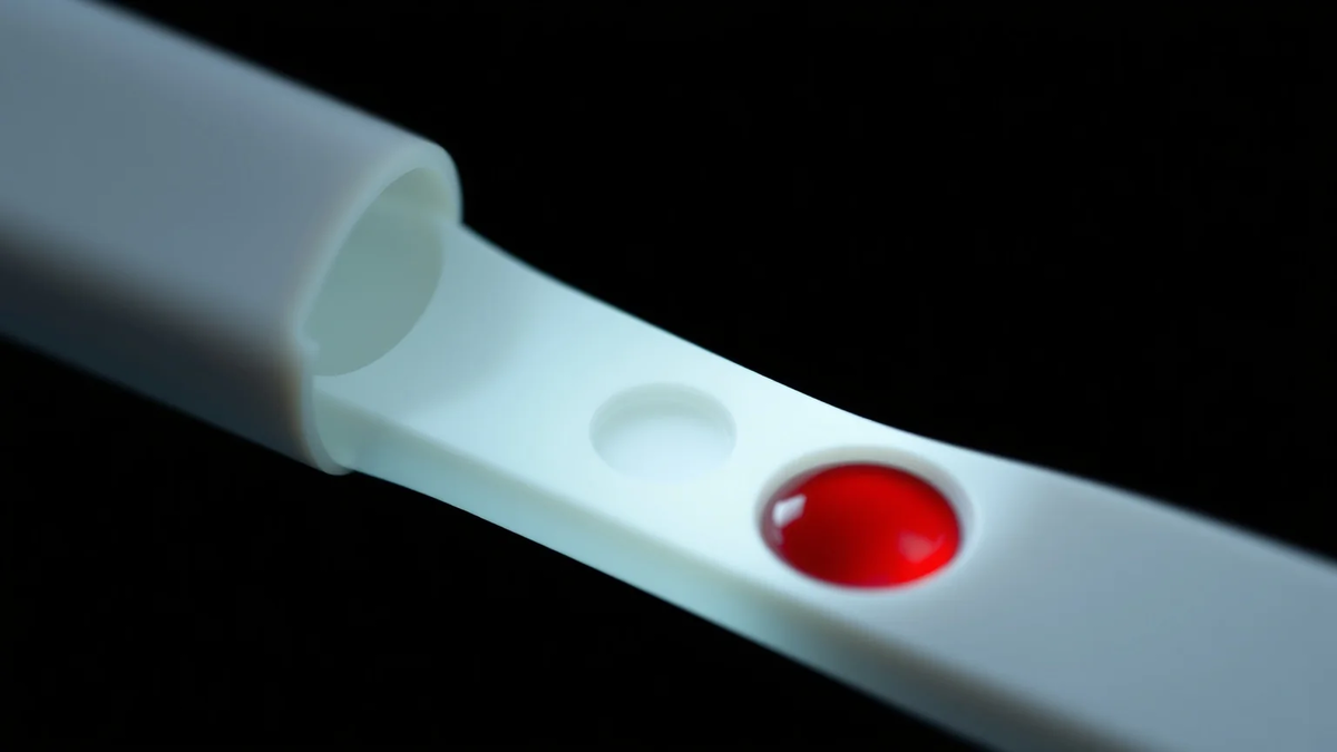 Alzheimer-Diagnose: Bluttest per Fingerstich revolutioniert Früherkennung - Foto: über boerse-global.de