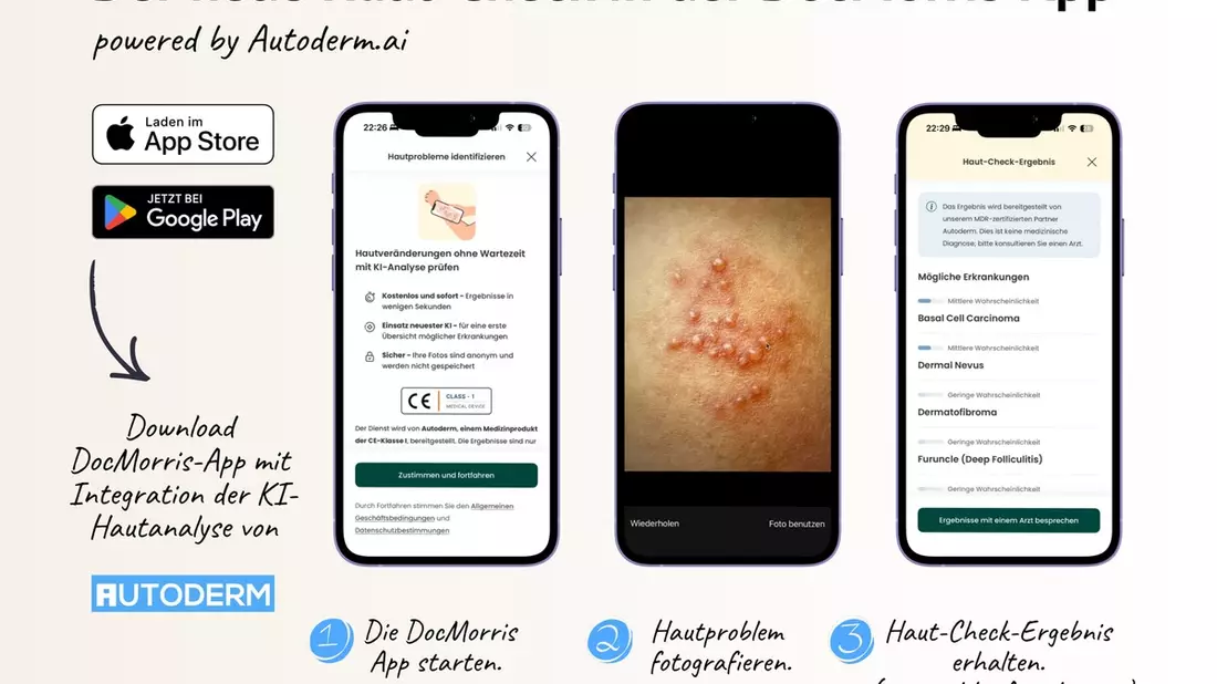 Autoderm ergänzt digitales Gesundheitsökosystem von DocMorris mit KI-Hautanalyse - Bild: presseportal.de