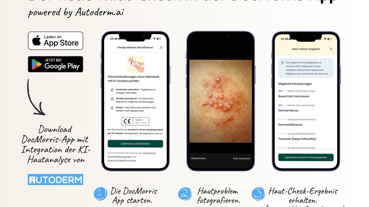 Autoderm ergänzt digitales Gesundheitsökosystem von DocMorris mit KI-Hautanalyse - Foto: presseportal.de