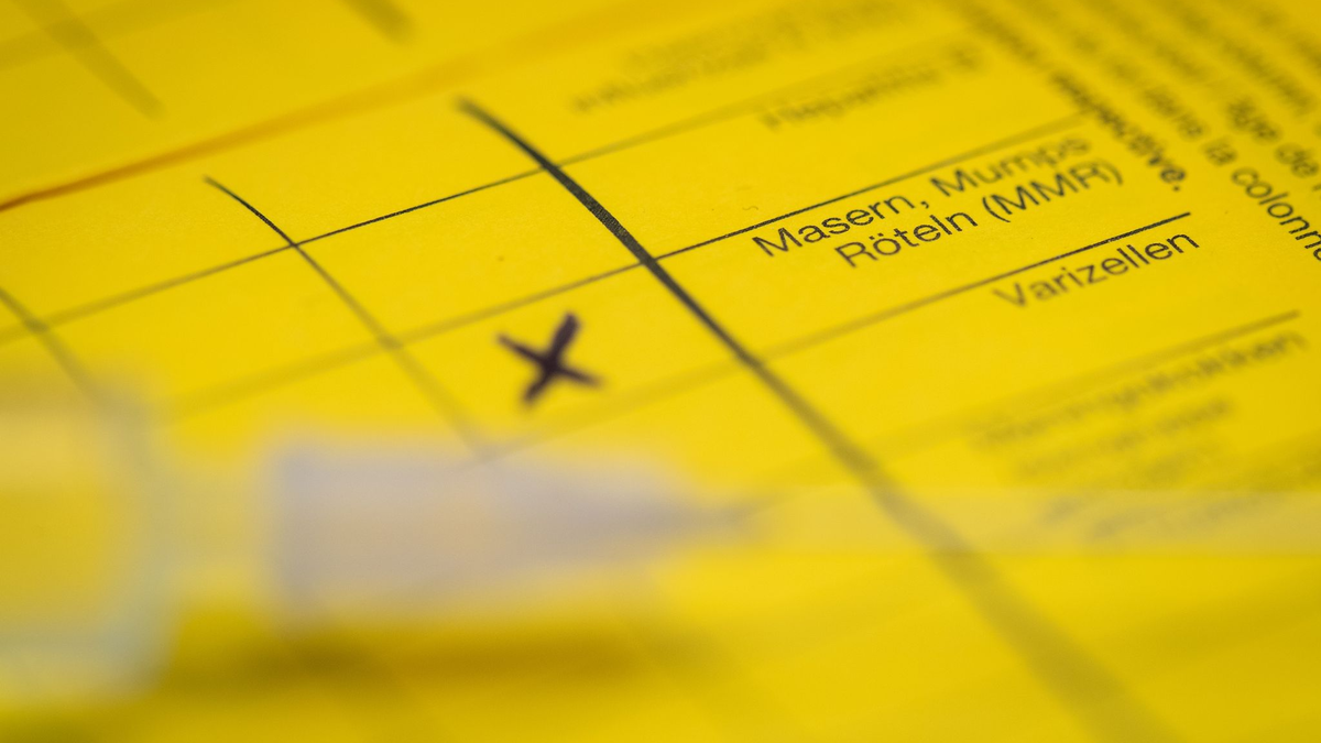 Bei Masern zeigt sich erst oft Fieber, bevor später ein Hautausschlag dazukommt. (Symbolbild) - Foto: Friso Gentsch/dpa