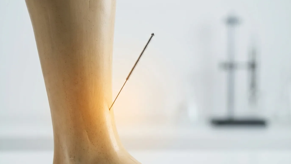 Akupunkturpunkt Milz 6: Neue Studien belegen zentrale Rolle bei Hormonstörungen - Foto: über boerse-global.de