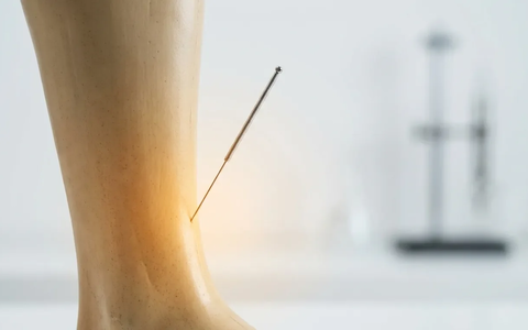 Akupunkturpunkt Milz 6: Neue Studien belegen zentrale Rolle bei Hormonstörungen - Foto: über boerse-global.de