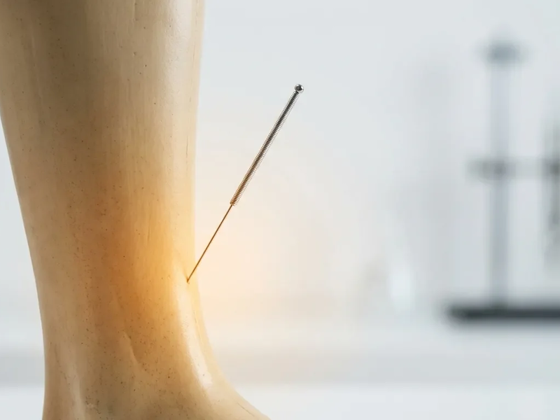 Akupunkturpunkt Milz 6: Neue Studien belegen zentrale Rolle bei Hormonstörungen - Foto: über boerse-global.de