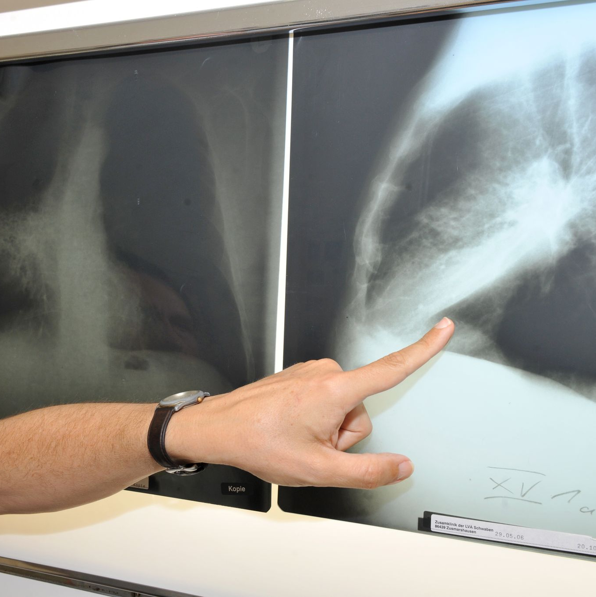 Im Winter weniger zu lüften, kann die Belastung mit krebserregendem Radon in der Wohnung erhöhen. (Archivbild) - Foto: Felix Hörhager/dpa