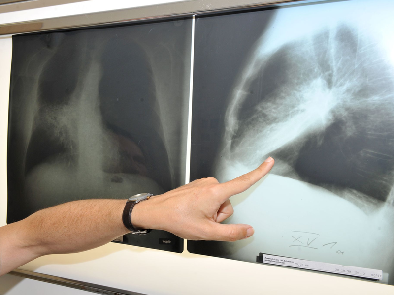 Im Winter weniger zu lüften, kann die Belastung mit krebserregendem Radon in der Wohnung erhöhen. (Archivbild) - Foto: Felix Hörhager/dpa