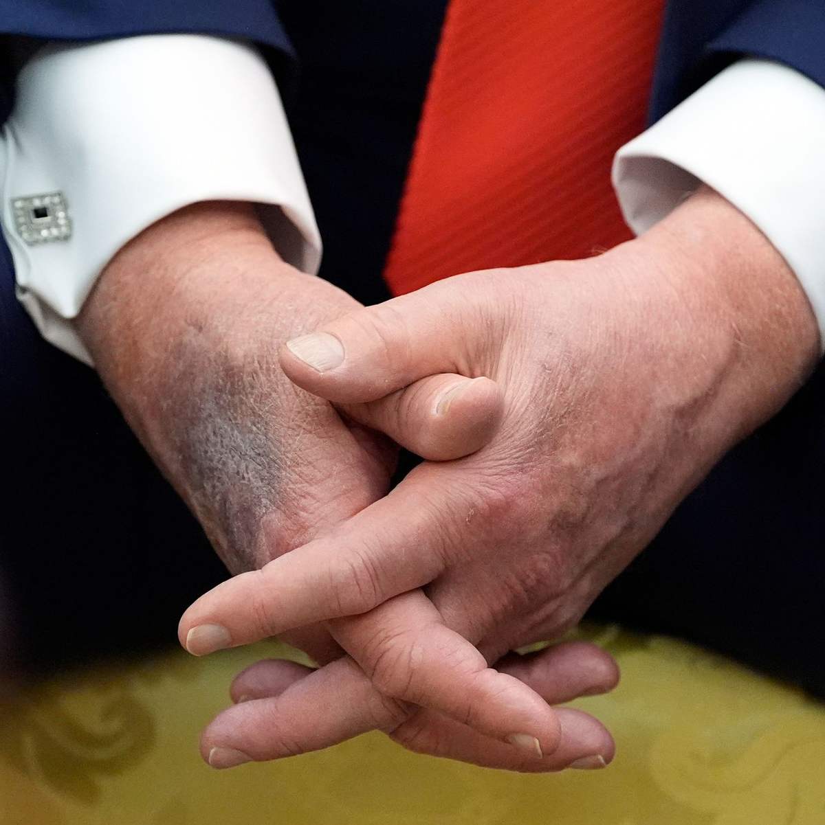 Blaue Flecken geben immer wieder Anlass für Spekulationen. (Archivbild) - Foto: Alex Brandon/AP/dpa