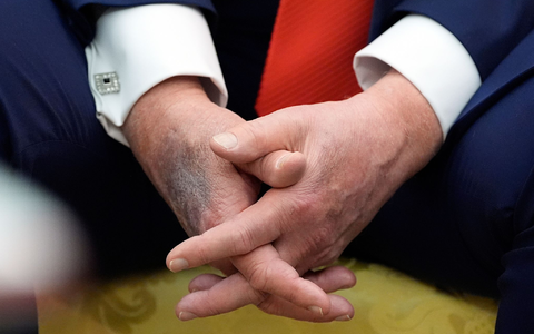 Blaue Flecken geben immer wieder Anlass für Spekulationen. (Archivbild) - Foto: Alex Brandon/AP/dpa