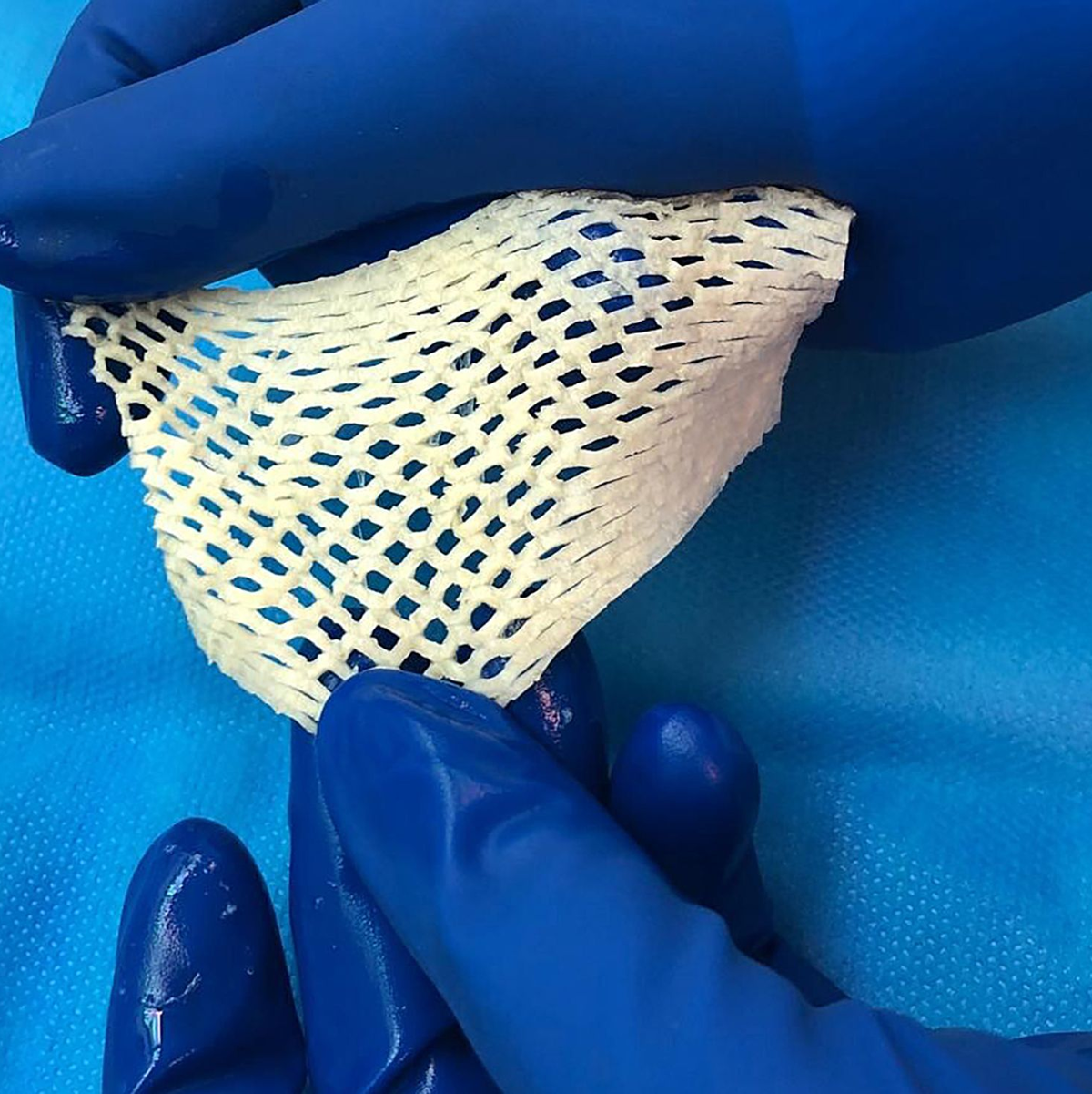 Wichtige Alternative für Hautttansplantationen: Fischhaut. - Foto: Saziye Karaca/-/dpa