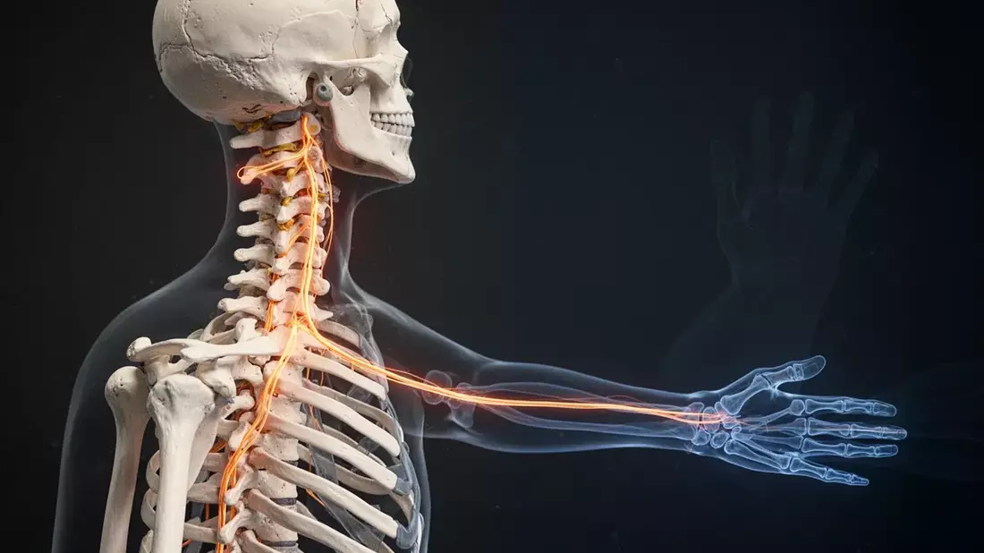 Nacken-Arm-Syndrom: Wenn der Schmerz bis in die Finger zieht - Bild: über boerse-global.de