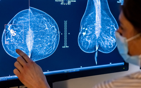 2023 wurden rund eine halbe Million Menschen in Deutschland mit Krebs diagnostiziert. (Symbolbild) - Foto: Hannibal Hanschke/dpa