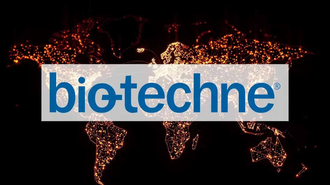 Bio-Techne’s Strategic Pivot: Can Automation and High-Margin Tools Reignite Growth? - Bild: über boerse-global.de