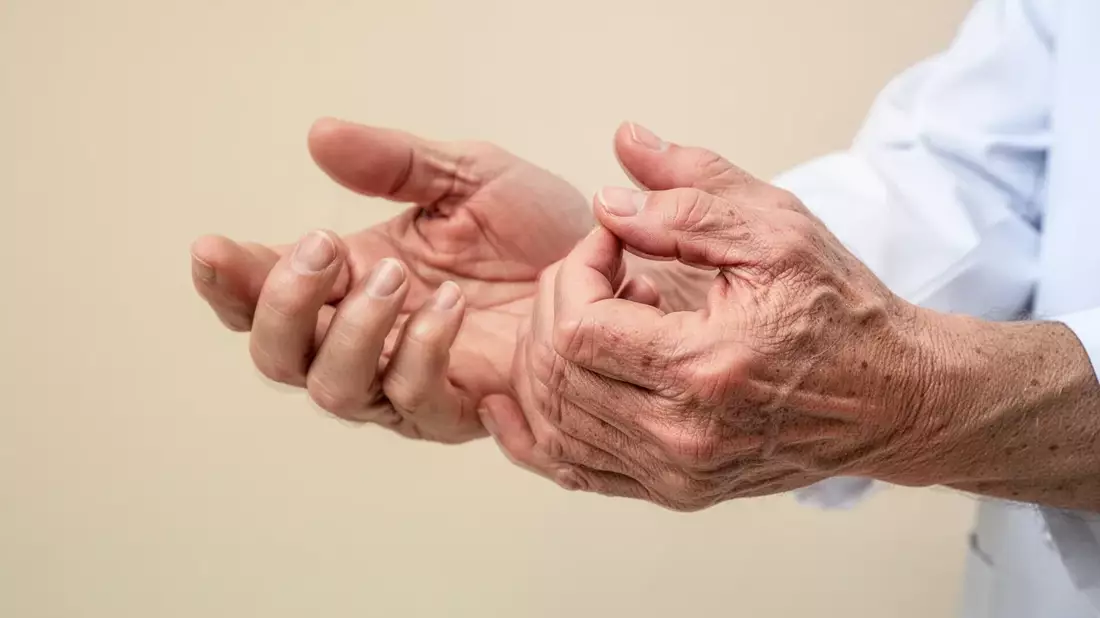 Fingerarthrose: Mit Bewegung und Gelenkschutz gegen den Schmerz - Bild: über boerse-global.de