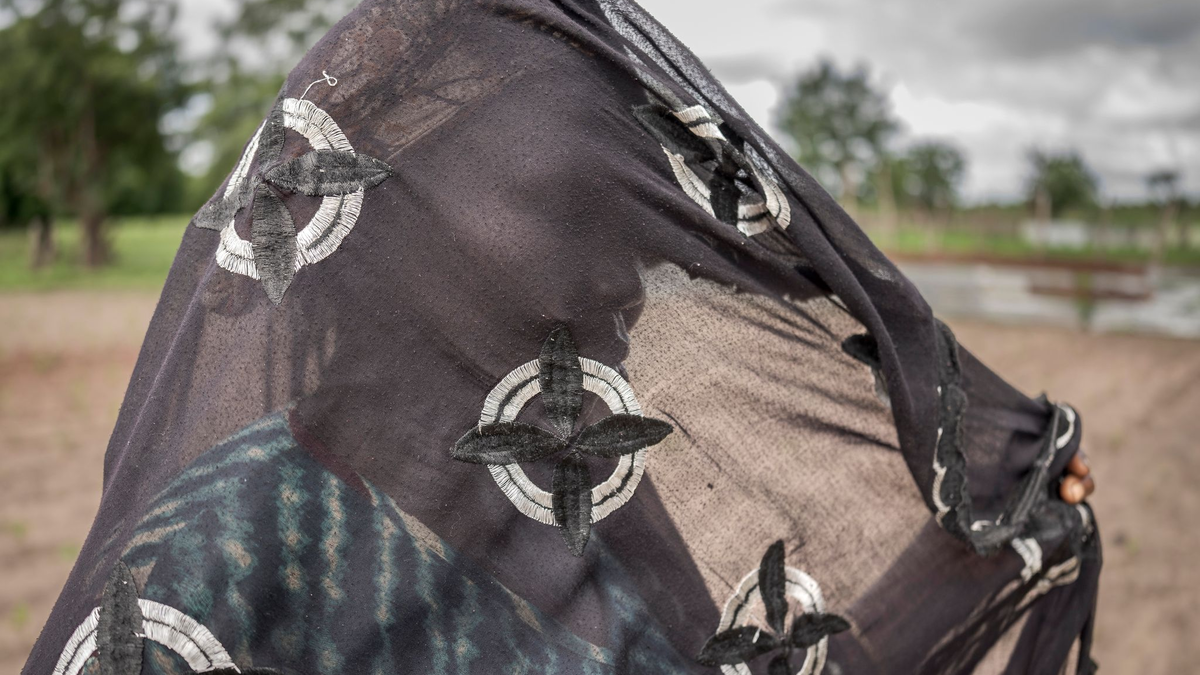 Betroffene haben oft lebenslang mit Komplikationen zu kämpfen. (Archivbild)  - Foto: Annika Hammerschlag/AP/dpa