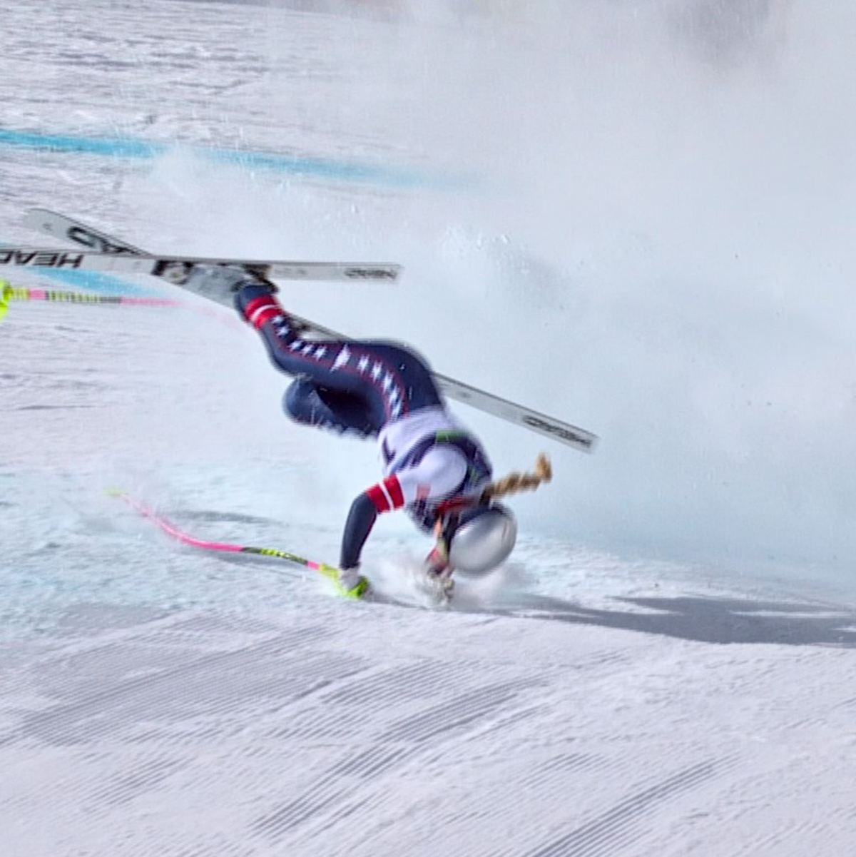 Die 41-Jährige musste operiert werden. - Foto: Uncredited/Olympic Broadcasting Services via AP/dpa