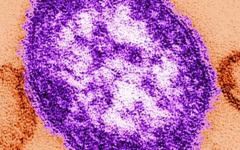 Die Abbildung mit Hilfe eines Transmissionselektronenmikroskops zeigt Teile eines Masernvirus - Foto: Cynthia Goldsmith/Centers for Disease Contról and Prevention/dpa