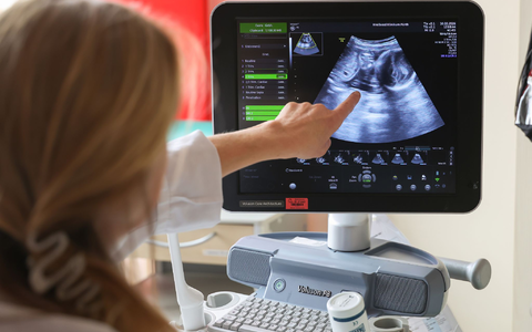 Auf dem Ultraschallbild ist laut der Ärztin zu sehen, dass Jasmin Schmidt wieder Zwillingsmädchen bekommt. - Foto: Daniel Löb/dpa Auf dem Ultraschallbild ist laut der Ärztin zu sehen, dass Jasmin Schmidt wieder Zwillingsmädchen bekommt. - Foto: Daniel Löb/dpa